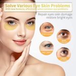 Under Eye Patches - 30 Pairs - 24K Gold Eye Mask- Puffy Eyes & Dark Circles Treatments, Eye Skin Care Pads With Collagen - Image 2