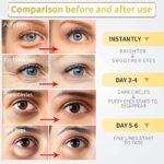 Under Eye Patches - 30 Pairs - 24K Gold Eye Mask- Puffy Eyes & Dark Circles Treatments, Eye Skin Care Pads With Collagen - Image 4